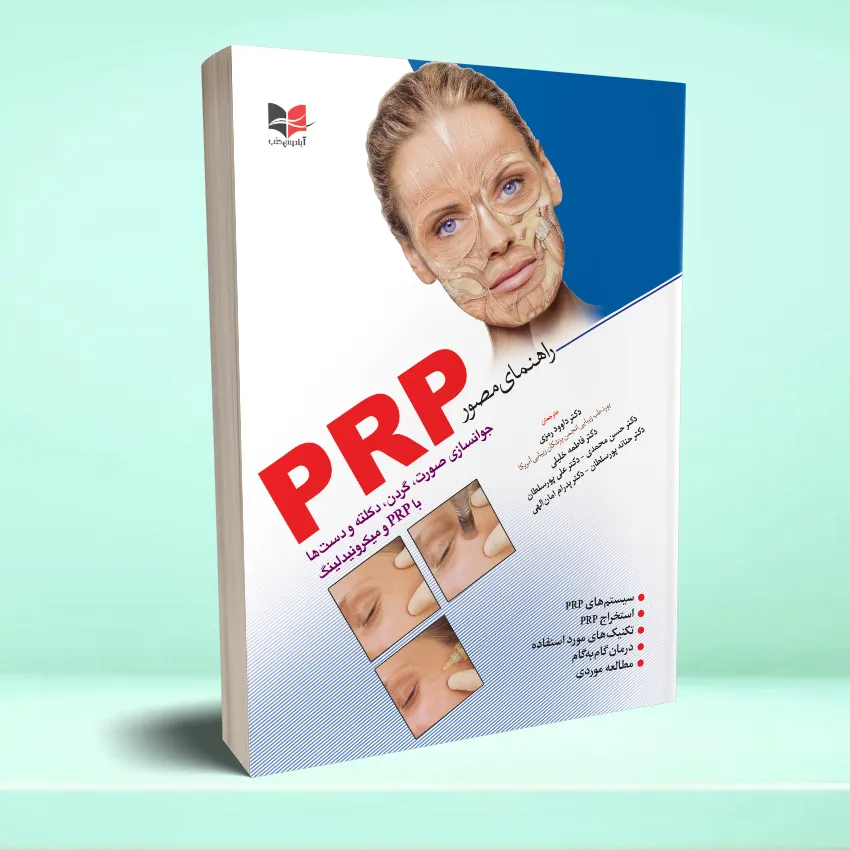 rahnamaye mosavar prp راهنمای مصور PRP - تصویر 1